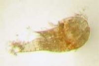 ヒライソミジンコ