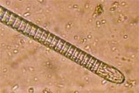 センチュウの仲間